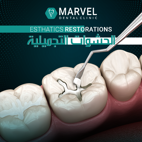 Asthatics restorations